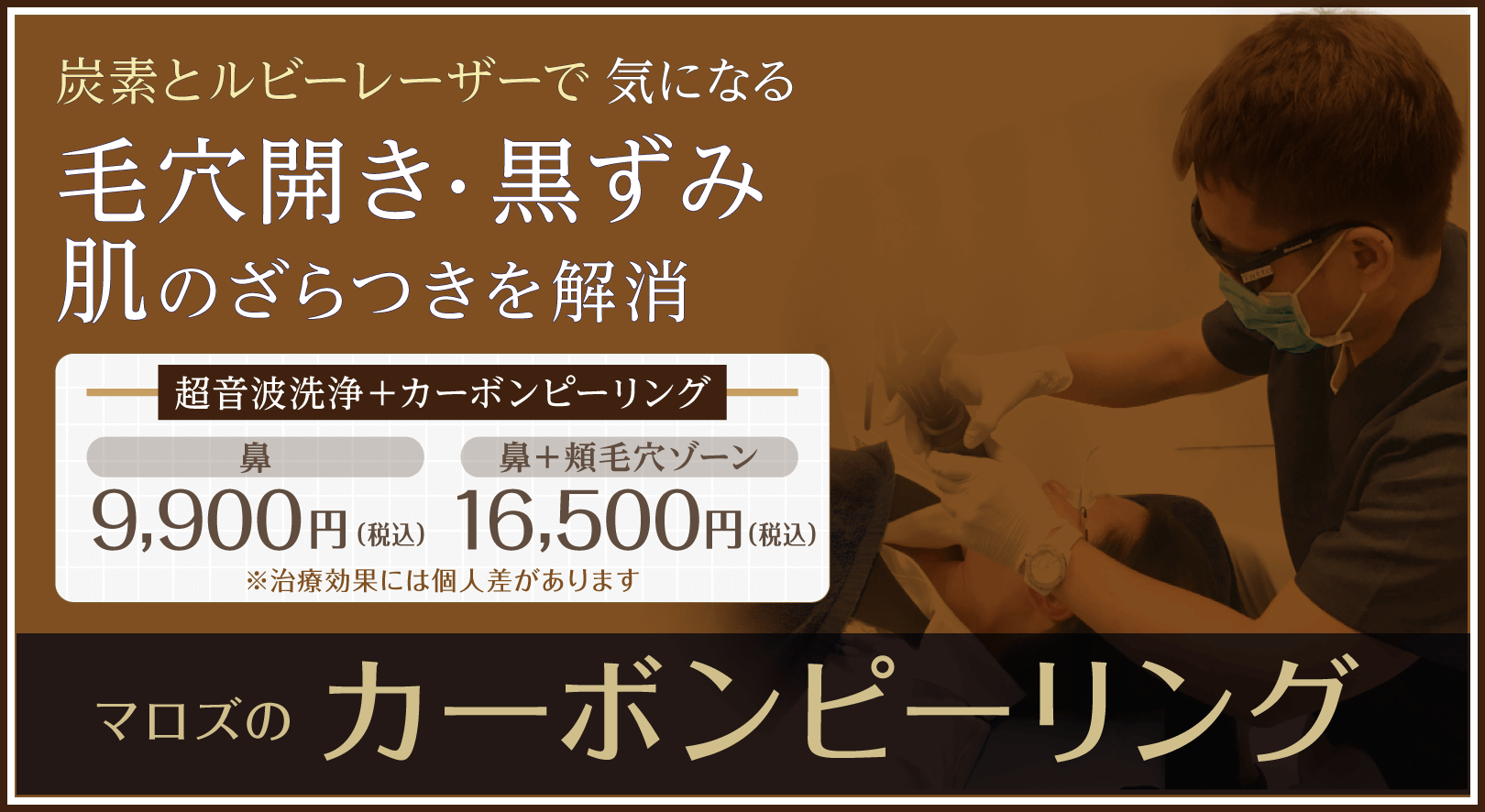 超音波洗浄＋カーボンピーリング 鼻9,900円／鼻＋頬毛穴ゾーン16,500円 ＊治療効果には個人差があります