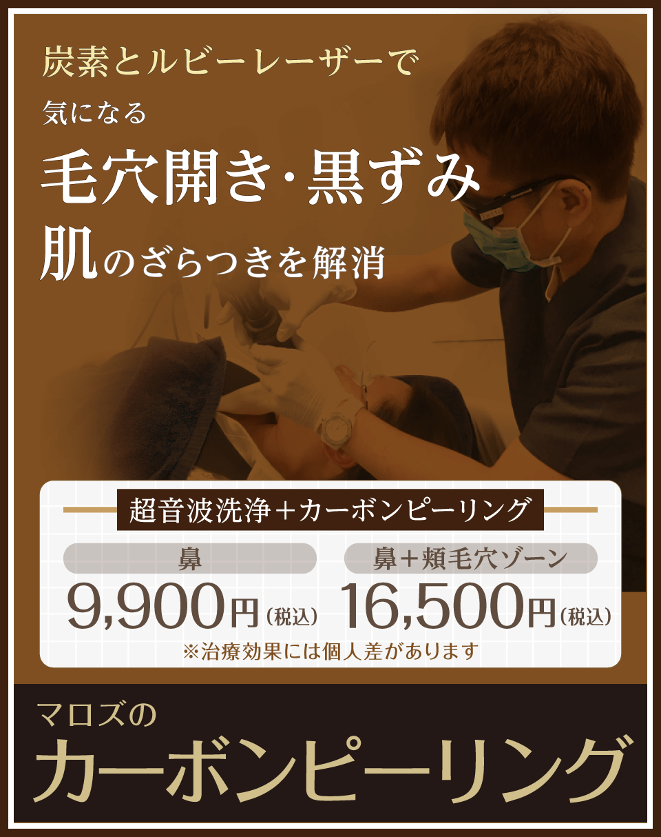 超音波洗浄＋カーボンピーリング 鼻9,900円／鼻＋頬毛穴ゾーン16,500円 ＊治療効果には個人差があります