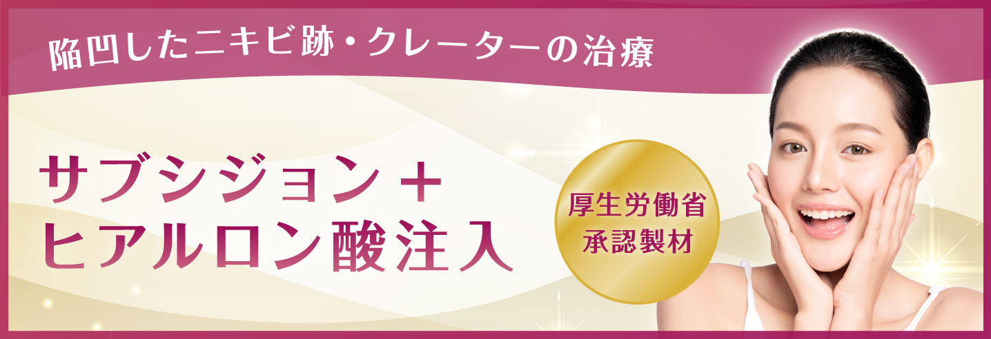 サブシジョン