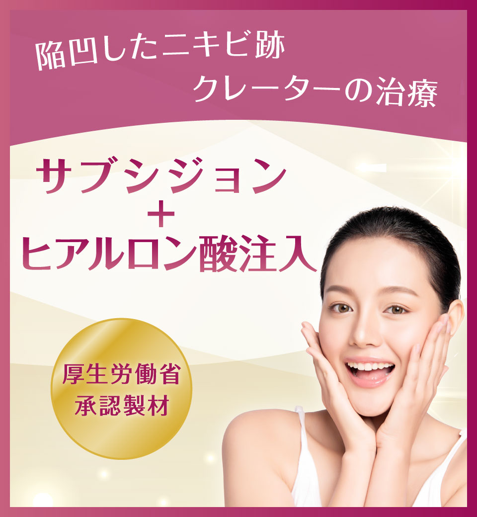 サブシジョン